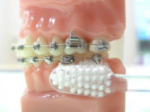 Prophylaxe Zahnpflege